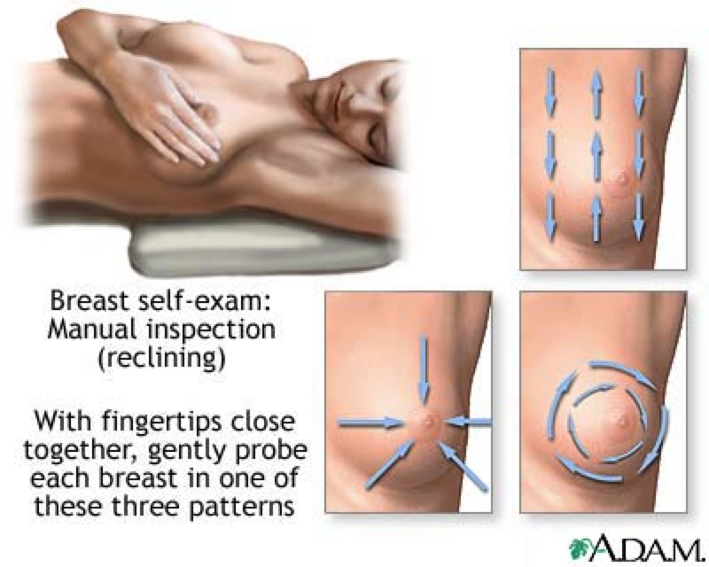 breast examination 2